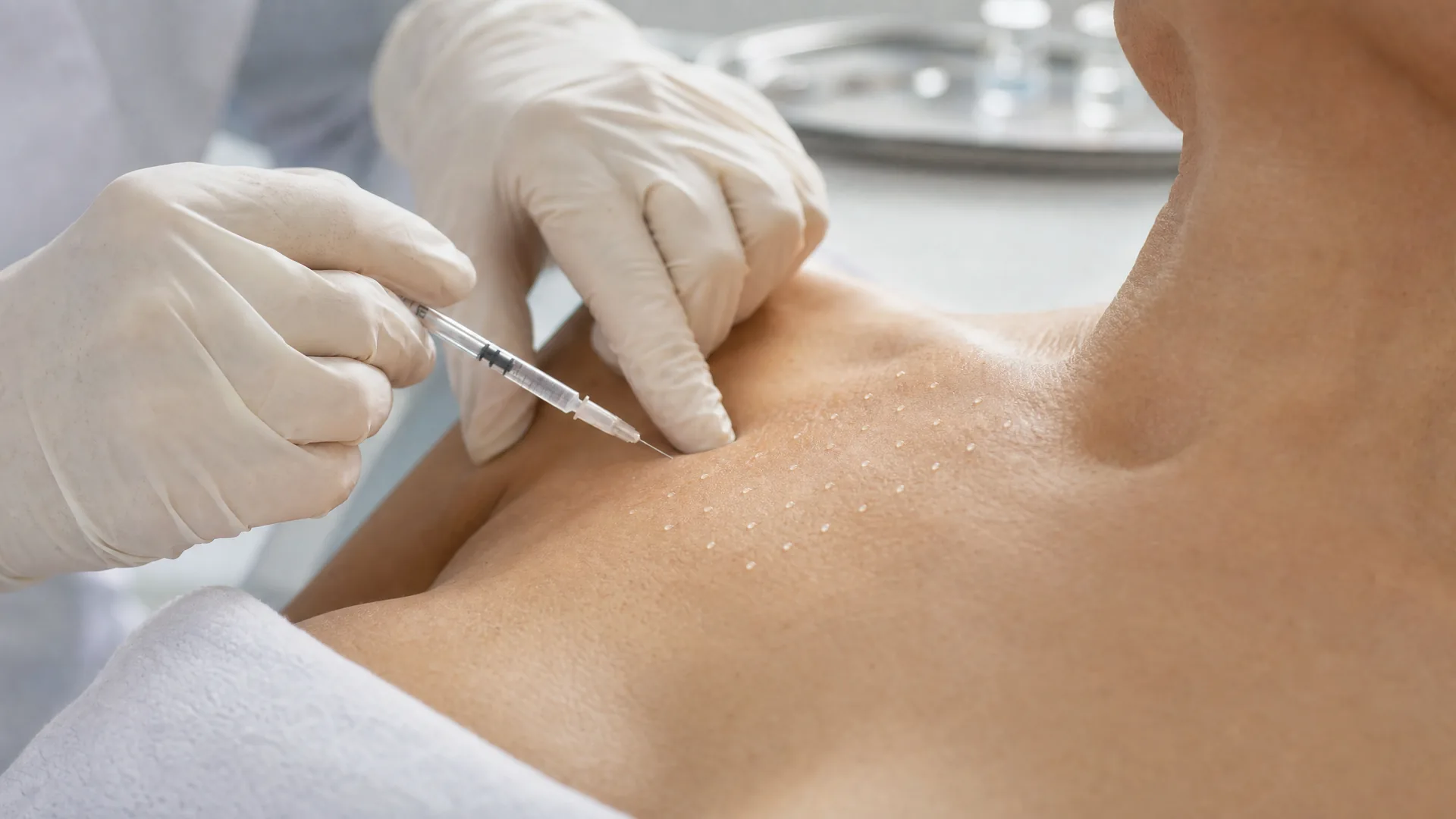 Intradermale Mikrodepots als Technik der Skinbooster Behandlung