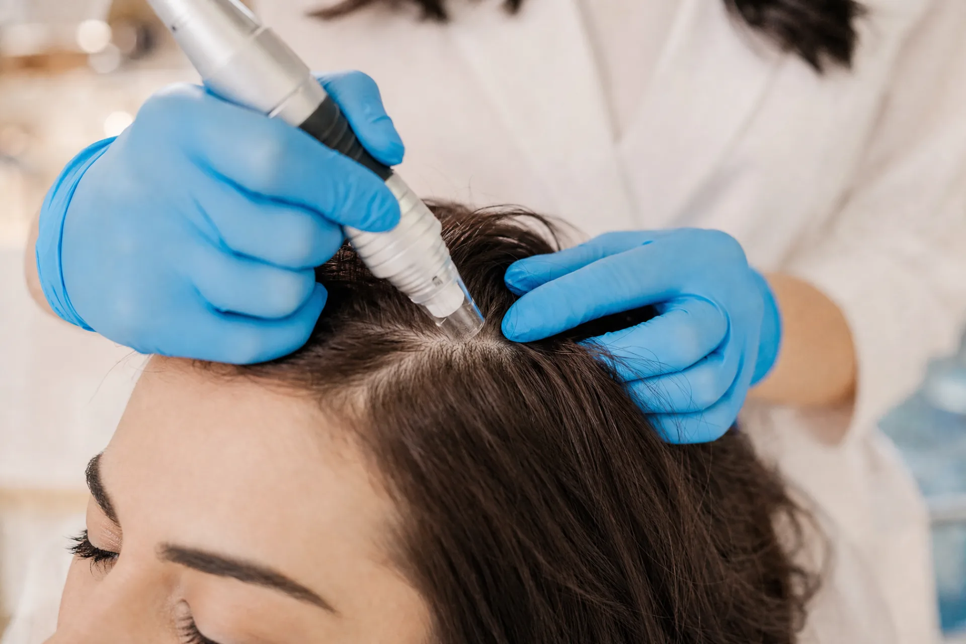 PRP-Behandlung Haare: Impulse für die Kopfhaut